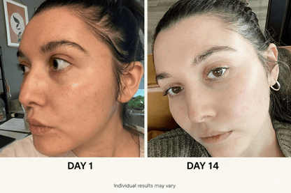 Ultimate Korean Skincare Set