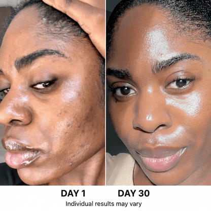 Ultimate Korean Skincare Set