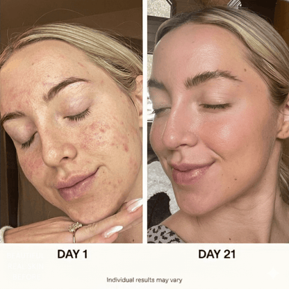 Ultimate Korean Skincare Set