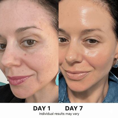 Ultimate Korean Skincare Set