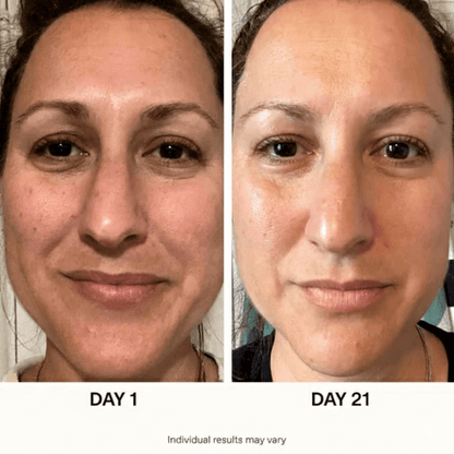 Ultimate Korean Skincare Set