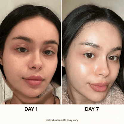 Ultimate Korean Skincare Set